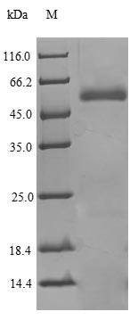 (Tris-Glycine gel) Discontinuous SDS-PAGE (reduced) with 5% enrichment gel and 15% separation gel. (Tris-Glycine gel) Discontinuous SDS-PAGE (reduced) with 5% enrichment gel and 15% separation gel.