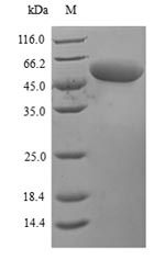 (Tris-Glycine gel) Discontinuous SDS-PAGE (reduced) with 5% enrichment gel and 15% separation gel. (Tris-Glycine gel) Discontinuous SDS-PAGE (reduced) with 5% enrichment gel and 15% separation gel.