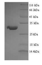 (Tris-Glycine gel) Discontinuous SDS-PAGE (reduced) with 5% enrichment gel and 15% separation gel. (Tris-Glycine gel) Discontinuous SDS-PAGE (reduced) with 5% enrichment gel and 15% separation gel.