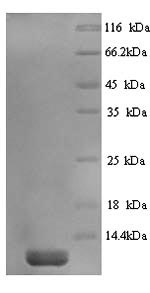 (Tris-Glycine gel) Discontinuous SDS-PAGE (reduced) with 5% enrichment gel and 15% separation gel. (Tris-Glycine gel) Discontinuous SDS-PAGE (reduced) with 5% enrichment gel and 15% separation gel.