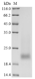 SDS-PAGE- Recombinant protein Human PSCA