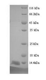 (Tris-Glycine gel) Discontinuous SDS-PAGE (reduced) with 5% enrichment gel and 15% separation gel. (Tris-Glycine gel) Discontinuous SDS-PAGE (reduced) with 5% enrichment gel and 15% separation gel.