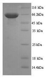 SDS-PAGE- Recombinant protein Human PTPRC