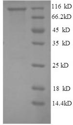 (Tris-Glycine gel) Discontinuous SDS-PAGE (reduced) with 5% enrichment gel and 15% separation gel. (Tris-Glycine gel) Discontinuous SDS-PAGE (reduced) with 5% enrichment gel and 15% separation gel.
