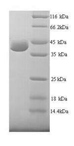 (Tris-Glycine gel) Discontinuous SDS-PAGE (reduced) with 5% enrichment gel and 15% separation gel. (Tris-Glycine gel) Discontinuous SDS-PAGE (reduced) with 5% enrichment gel and 15% separation gel.