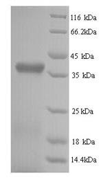 (Tris-Glycine gel) Discontinuous SDS-PAGE (reduced) with 5% enrichment gel and 15% separation gel. (Tris-Glycine gel) Discontinuous SDS-PAGE (reduced) with 5% enrichment gel and 15% separation gel.