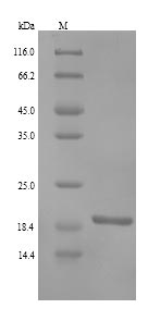 (Tris-Glycine gel) Discontinuous SDS-PAGE (reduced) with 5% enrichment gel and 15% separation gel. (Tris-Glycine gel) Discontinuous SDS-PAGE (reduced) with 5% enrichment gel and 15% separation gel.