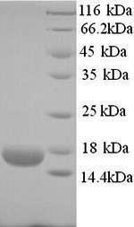 (Tris-Glycine gel) Discontinuous SDS-PAGE (reduced) with 5% enrichment gel and 15% separation gel. (Tris-Glycine gel) Discontinuous SDS-PAGE (reduced) with 5% enrichment gel and 15% separation gel.