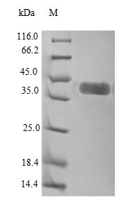 (Tris-Glycine gel) Discontinuous SDS-PAGE (reduced) with 5% enrichment gel and 15% separation gel. (Tris-Glycine gel) Discontinuous SDS-PAGE (reduced) with 5% enrichment gel and 15% separation gel.