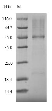 (Tris-Glycine gel) Discontinuous SDS-PAGE (reduced) with 5% enrichment gel and 15% separation gel. (Tris-Glycine gel) Discontinuous SDS-PAGE (reduced) with 5% enrichment gel and 15% separation gel.