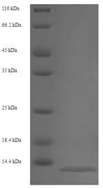 (Tris-Glycine gel) Discontinuous SDS-PAGE (reduced) with 5% enrichment gel and 15% separation gel. (Tris-Glycine gel) Discontinuous SDS-PAGE (reduced) with 5% enrichment gel and 15% separation gel.
