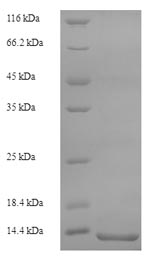 (Tris-Glycine gel) Discontinuous SDS-PAGE (reduced) with 5% enrichment gel and 15% separation gel. (Tris-Glycine gel) Discontinuous SDS-PAGE (reduced) with 5% enrichment gel and 15% separation gel.