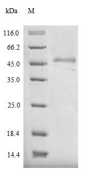 SDS-PAGE- Recombinant protein Pig SELE