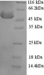 (Tris-Glycine gel) Discontinuous SDS-PAGE (reduced) with 5% enrichment gel and 15% separation gel. (Tris-Glycine gel) Discontinuous SDS-PAGE (reduced) with 5% enrichment gel and 15% separation gel.