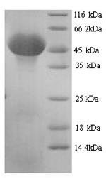 (Tris-Glycine gel) Discontinuous SDS-PAGE (reduced) with 5% enrichment gel and 15% separation gel. (Tris-Glycine gel) Discontinuous SDS-PAGE (reduced) with 5% enrichment gel and 15% separation gel.