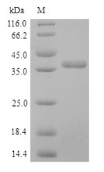 (Tris-Glycine gel) Discontinuous SDS-PAGE (reduced) with 5% enrichment gel and 15% separation gel. (Tris-Glycine gel) Discontinuous SDS-PAGE (reduced) with 5% enrichment gel and 15% separation gel.