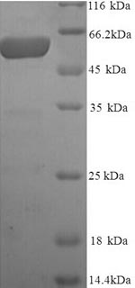 (Tris-Glycine gel) Discontinuous SDS-PAGE (reduced) with 5% enrichment gel and 15% separation gel. (Tris-Glycine gel) Discontinuous SDS-PAGE (reduced) with 5% enrichment gel and 15% separation gel.