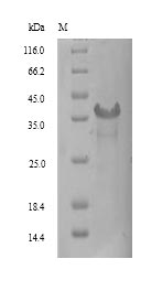 SDS-PAGE- Recombinant protein Human SIRPG