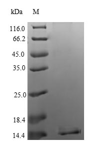 (Tris-Glycine gel) Discontinuous SDS-PAGE (reduced) with 5% enrichment gel and 15% separation gel. (Tris-Glycine gel) Discontinuous SDS-PAGE (reduced) with 5% enrichment gel and 15% separation gel.