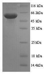 (Tris-Glycine gel) Discontinuous SDS-PAGE (reduced) with 5% enrichment gel and 15% separation gel. (Tris-Glycine gel) Discontinuous SDS-PAGE (reduced) with 5% enrichment gel and 15% separation gel.