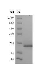 (Tris-Glycine gel) Discontinuous SDS-PAGE (reduced) with 5% enrichment gel and 15% separation gel. (Tris-Glycine gel) Discontinuous SDS-PAGE (reduced) with 5% enrichment gel and 15% separation gel.