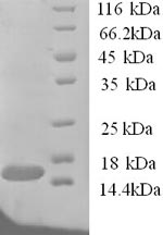 (Tris-Glycine gel) Discontinuous SDS-PAGE (reduced) with 5% enrichment gel and 15% separation gel. (Tris-Glycine gel) Discontinuous SDS-PAGE (reduced) with 5% enrichment gel and 15% separation gel.