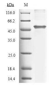 (Tris-Glycine gel) Discontinuous SDS-PAGE (reduced) with 5% enrichment gel and 15% separation gel. (Tris-Glycine gel) Discontinuous SDS-PAGE (reduced) with 5% enrichment gel and 15% separation gel.