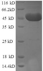 (Tris-Glycine gel) Discontinuous SDS-PAGE (reduced) with 5% enrichment gel and 15% separation gel. (Tris-Glycine gel) Discontinuous SDS-PAGE (reduced) with 5% enrichment gel and 15% separation gel.