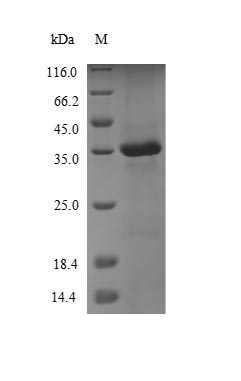 (Tris-Glycine gel) Discontinuous SDS-PAGE (reduced) with 5% enrichment gel and 15% separation gel. (Tris-Glycine gel) Discontinuous SDS-PAGE (reduced) with 5% enrichment gel and 15% separation gel.