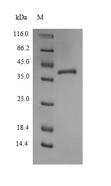 (Tris-Glycine gel) Discontinuous SDS-PAGE (reduced) with 5% enrichment gel and 15% separation gel. (Tris-Glycine gel) Discontinuous SDS-PAGE (reduced) with 5% enrichment gel and 15% separation gel.