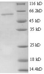 (Tris-Glycine gel) Discontinuous SDS-PAGE (reduced) with 5% enrichment gel and 15% separation gel. (Tris-Glycine gel) Discontinuous SDS-PAGE (reduced) with 5% enrichment gel and 15% separation gel.