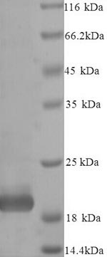 (Tris-Glycine gel) Discontinuous SDS-PAGE (reduced) with 5% enrichment gel and 15% separation gel. (Tris-Glycine gel) Discontinuous SDS-PAGE (reduced) with 5% enrichment gel and 15% separation gel.