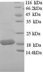 SDS-PAGE- Recombinant protein Sheep TNF