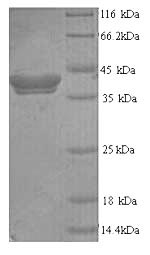 (Tris-Glycine gel) Discontinuous SDS-PAGE (reduced) with 5% enrichment gel and 15% separation gel. (Tris-Glycine gel) Discontinuous SDS-PAGE (reduced) with 5% enrichment gel and 15% separation gel.