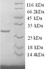 (Tris-Glycine gel) Discontinuous SDS-PAGE (reduced) with 5% enrichment gel and 15% separation gel. (Tris-Glycine gel) Discontinuous SDS-PAGE (reduced) with 5% enrichment gel and 15% separation gel.