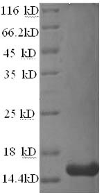 (Tris-Glycine gel) Discontinuous SDS-PAGE (reduced) with 5% enrichment gel and 15% separation gel. (Tris-Glycine gel) Discontinuous SDS-PAGE (reduced) with 5% enrichment gel and 15% separation gel.