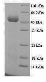 (Tris-Glycine gel) Discontinuous SDS-PAGE (reduced) with 5% enrichment gel and 15% separation gel. (Tris-Glycine gel) Discontinuous SDS-PAGE (reduced) with 5% enrichment gel and 15% separation gel.