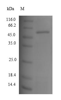 (Tris-Glycine gel) Discontinuous SDS-PAGE (reduced) with 5% enrichment gel and 15% separation gel. (Tris-Glycine gel) Discontinuous SDS-PAGE (reduced) with 5% enrichment gel and 15% separation gel.