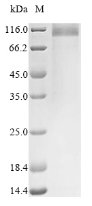 (Tris-Glycine gel) Discontinuous SDS-PAGE (reduced) with 5% enrichment gel and 15% separation gel. (Tris-Glycine gel) Discontinuous SDS-PAGE (reduced) with 5% enrichment gel and 15% separation gel.