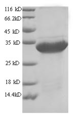 (Tris-Glycine gel) Discontinuous SDS-PAGE (reduced) with 5% enrichment gel and 15% separation gel.