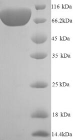 SDS-PAGE- Recombinant protein Human VCAM1