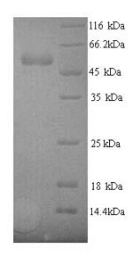 (Tris-Glycine gel) Discontinuous SDS-PAGE (reduced) with 5% enrichment gel and 15% separation gel. (Tris-Glycine gel) Discontinuous SDS-PAGE (reduced) with 5% enrichment gel and 15% separation gel.