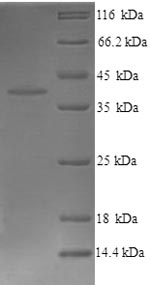 (Tris-Glycine gel) Discontinuous SDS-PAGE (reduced) with 5% enrichment gel and 15% separation gel. (Tris-Glycine gel) Discontinuous SDS-PAGE (reduced) with 5% enrichment gel and 15% separation gel.