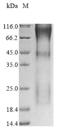 SDS-PAGE- Recombinant protein Human YAP1