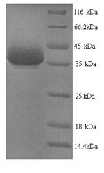 (Tris-Glycine gel) Discontinuous SDS-PAGE (reduced) with 5% enrichment gel and 15% separation gel. (Tris-Glycine gel) Discontinuous SDS-PAGE (reduced) with 5% enrichment gel and 15% separation gel.