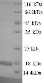 Recombinant Toxoplasma gondII Profilin (PRF) - image 1