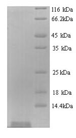 (Tris-Glycine gel) Discontinuous SDS-PAGE (reduced) with 5% enrichment gel and 15% separation gel. (Tris-Glycine gel) Discontinuous SDS-PAGE (reduced) with 5% enrichment gel and 15% separation gel.
