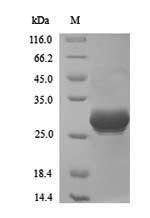 (Tris-Glycine gel) Discontinuous SDS-PAGE (reduced) with 5% enrichment gel and 15% separation gel. (Tris-Glycine gel) Discontinuous SDS-PAGE (reduced) with 5% enrichment gel and 15% separation gel.