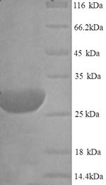 (Tris-Glycine gel) Discontinuous SDS-PAGE (reduced) with 5% enrichment gel and 15% separation gel. (Tris-Glycine gel) Discontinuous SDS-PAGE (reduced) with 5% enrichment gel and 15% separation gel.