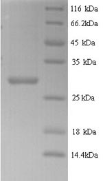 (Tris-Glycine gel) Discontinuous SDS-PAGE (reduced) with 5% enrichment gel and 15% separation gel. (Tris-Glycine gel) Discontinuous SDS-PAGE (reduced) with 5% enrichment gel and 15% separation gel.
